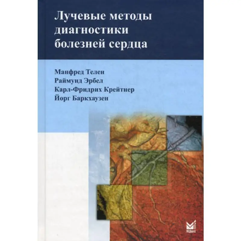 Книга Лучевые методы диагностики болезней сердца под общ. ред. В.Е. Синицына Телен М., Эрбел Р., Крейтнер К.-Ф., Баркхаузен Й.