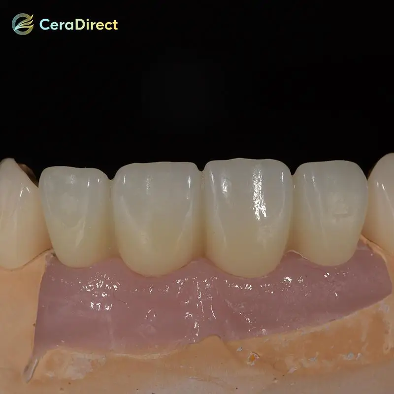 Фото Ceradirect 3D Pro многослойная циркониевая система AG (71 мм) — для стоматологической лаборатории CAD/CAM №3