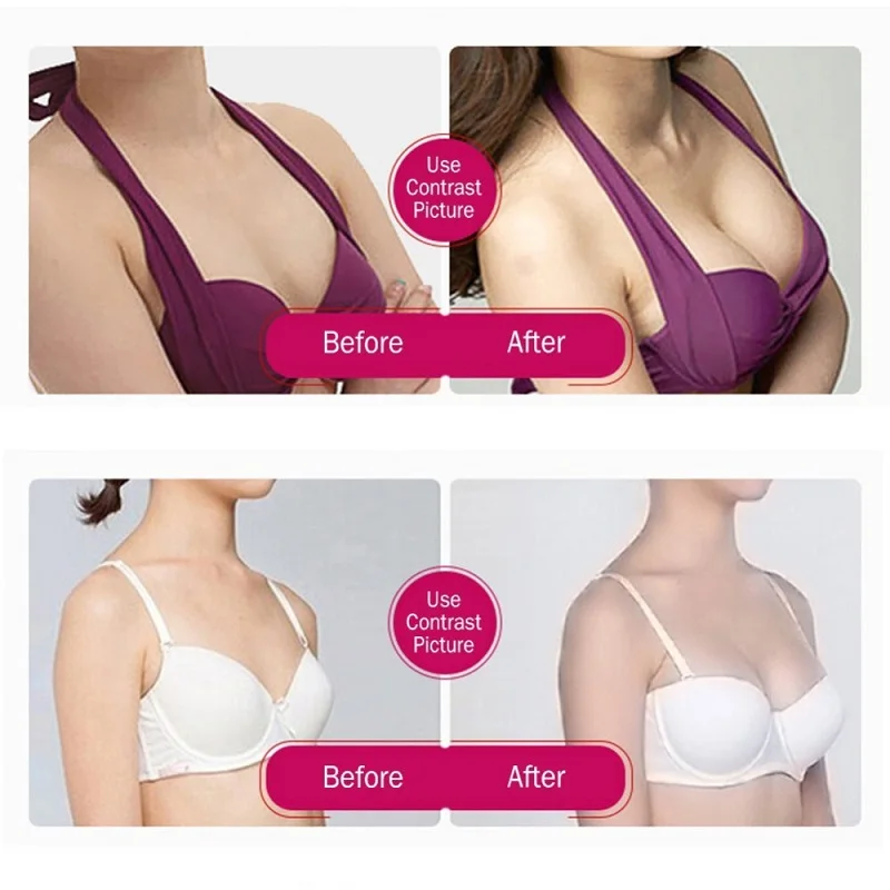 Фото Breast Enlargement Pump With 18CM Cups Vacuum Therapy Machine Butt Lift machine Butt Enhancer Vacuum Cups for Women Massage №2