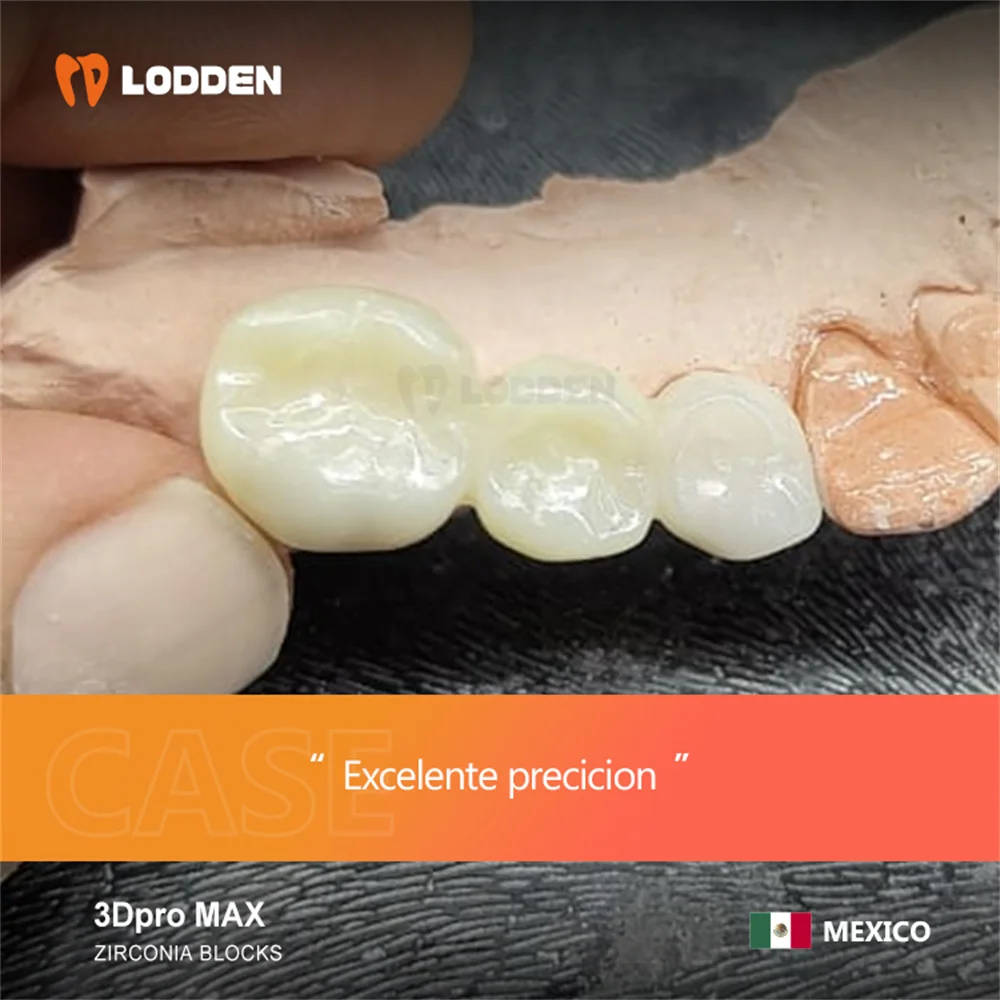 Фото LODDEN Dental Lab 3D Pro Max Цирконий 98*22 мм 5-слойные многослойные блоки Циркониевый диск Материалы для протезов Прозрачность 43%-51% №5