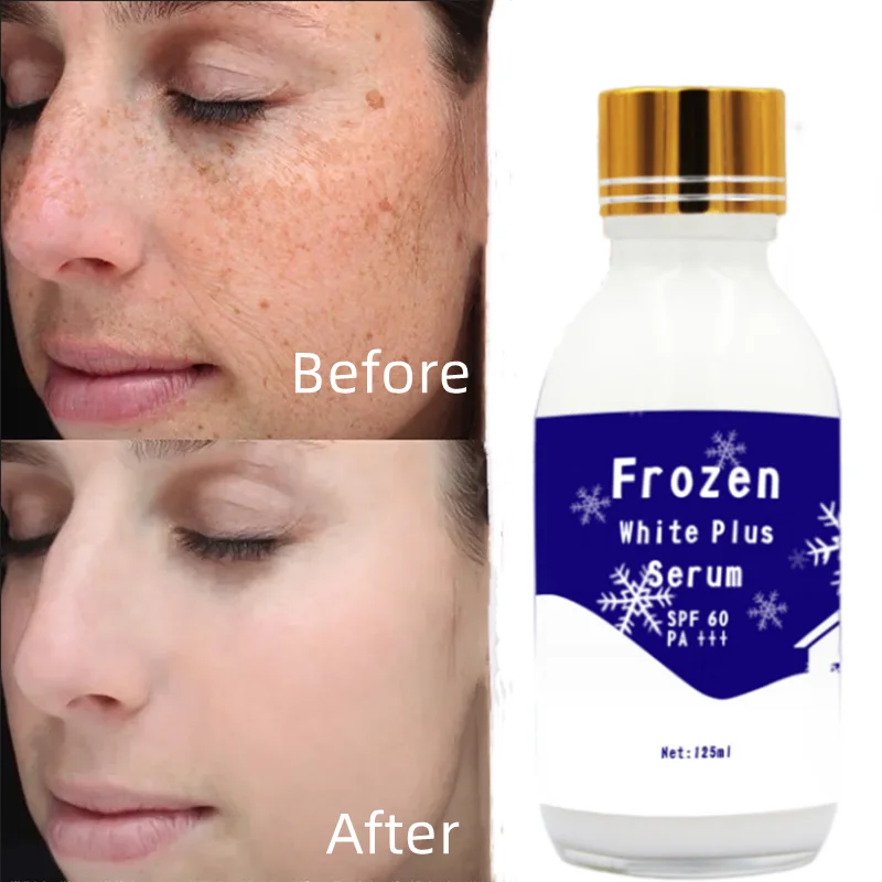 Коллагеновая сыворотка Kojic Sen Focus, 125 мл, сильное осветление, выцветание, тусклые пятна, более сияющая Сыворотка для лица