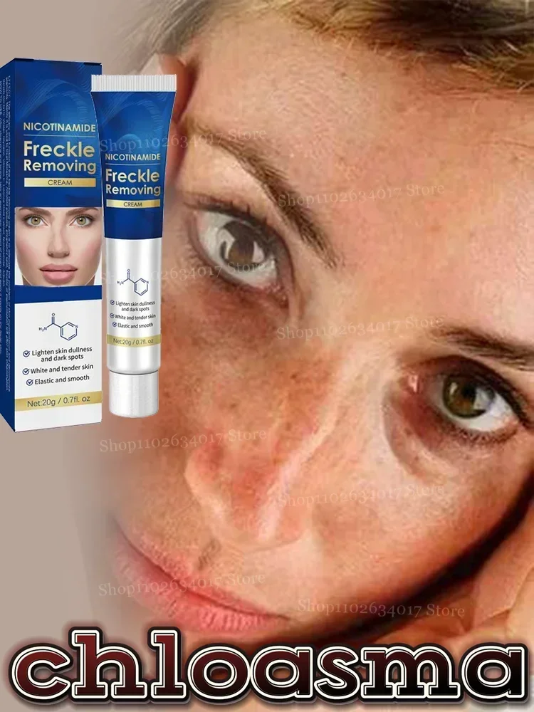 38Skincare Глубоко прозрачные пятна, омоложение кожи - натуральные ингредиенты, крем от веснушек, проблему прощайных пятен