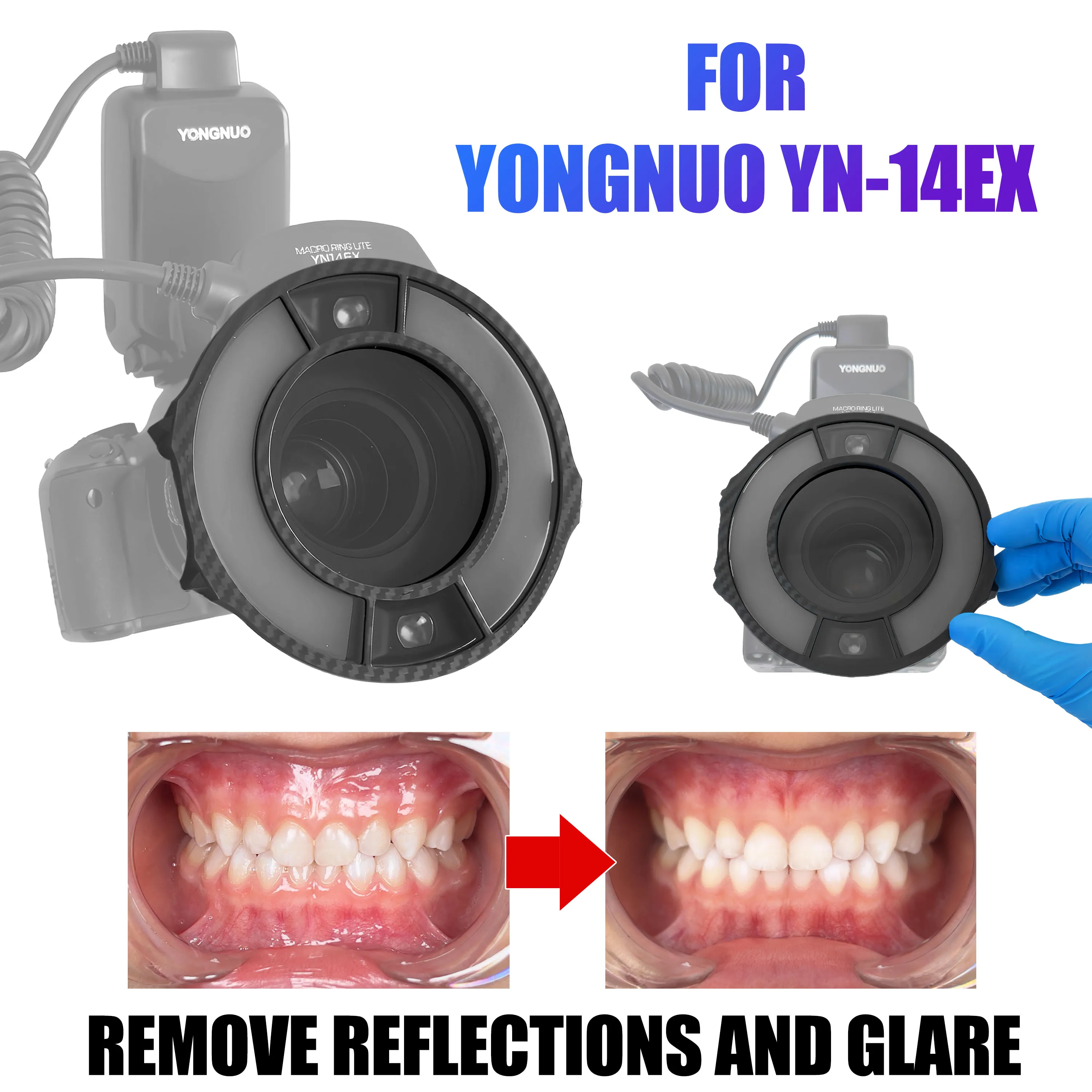 Поляризационный экран для YONGNUO YN-14EX FlashEliminate GlareSharp DentalPhotos, Capture TrueToothColors, PerfectforDentalClinics