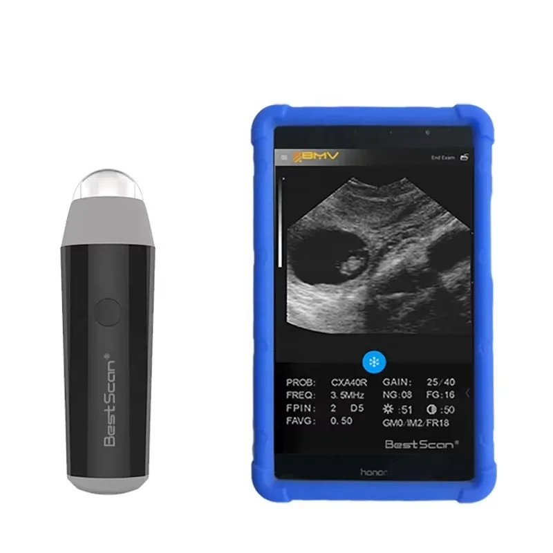 BestScan S3 Wireless Goat/Sheep/Pig/Sow/Scine Портативное ветеринарное ультразвуковое оборудование/машина/сканер