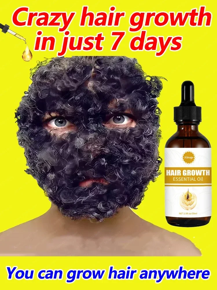 Óleo de crescimento rápido do cabelo para produtos homens mulheres
