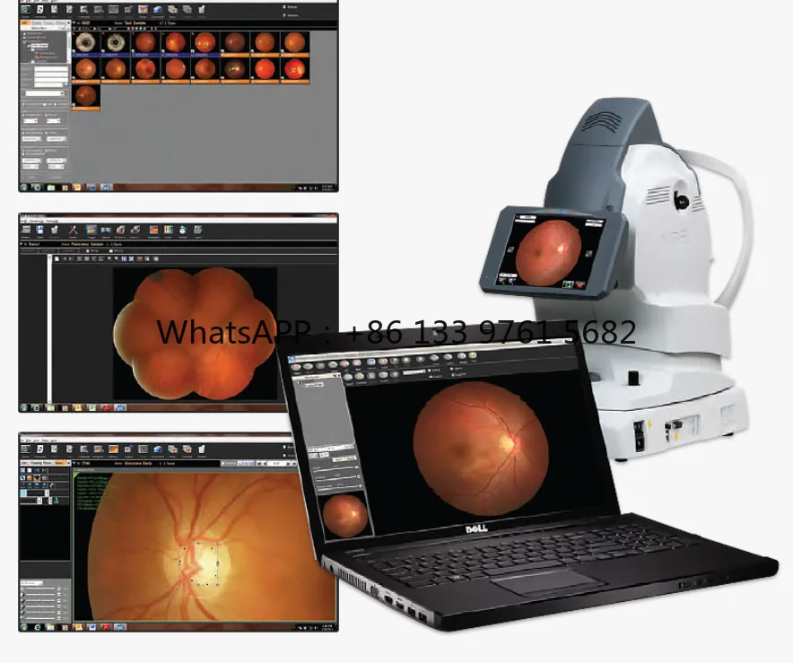 Nidek AFC-330 Auto Fundus Camera 8,4-дюймовый наклонный цветной ЖК-сенсорный экран Ультразвуковое электронное оборудование Fundus Camera Price (art.: 3920cfcb7fd24) - 3920cfcb7fd24