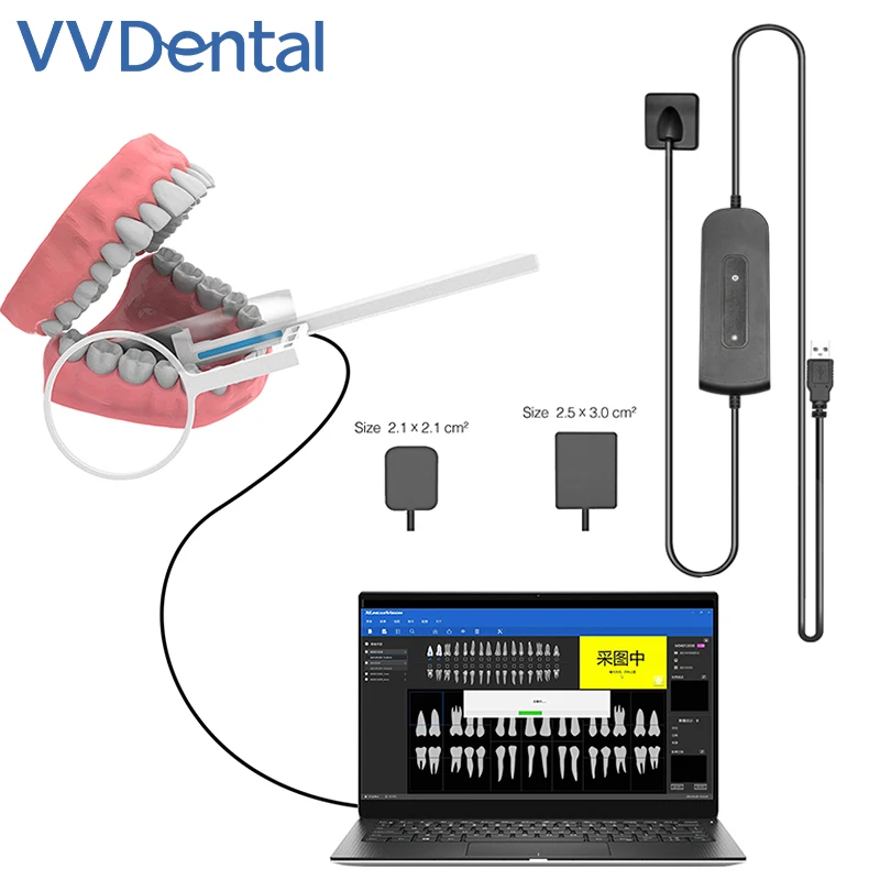 VVDental стоматологический датчик рентгенографический радиовиограф RVG высокочастотный цифровой датчик Интраоральная система lmaging датчик быстрой передачи