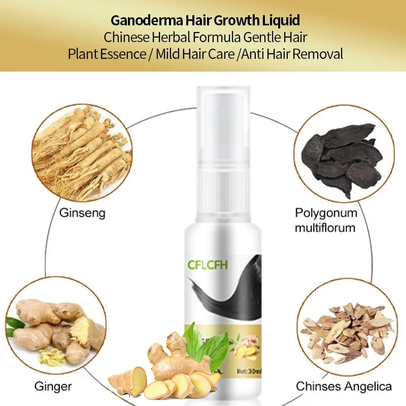 Спрей для роста волос Ginger Ganoderma Lucidum продукты против выпадения волос лечение кожи головы Уход за волосами для мужчин женщин 30 мл (art.: 3920c4b5dedb9) - 3920c4b5dedb9