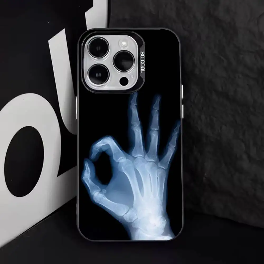 Фото Чехол для телефона X-RAY Radiological Skeleton для iPhone 16,15,14,13,12,11,8,7,Pro,Max,Plus,Mini,XS,SE Anti Fall Black Matte Hard №2