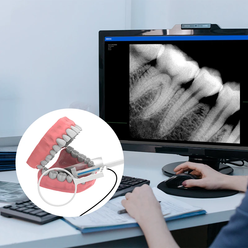 Фото Стоматологический датчик VVDental, рентгеновский высокочастотный Rx, внутриротовая цифровая система, стоматологический цифровой датчик, HD-изображение Radiovisografo №5