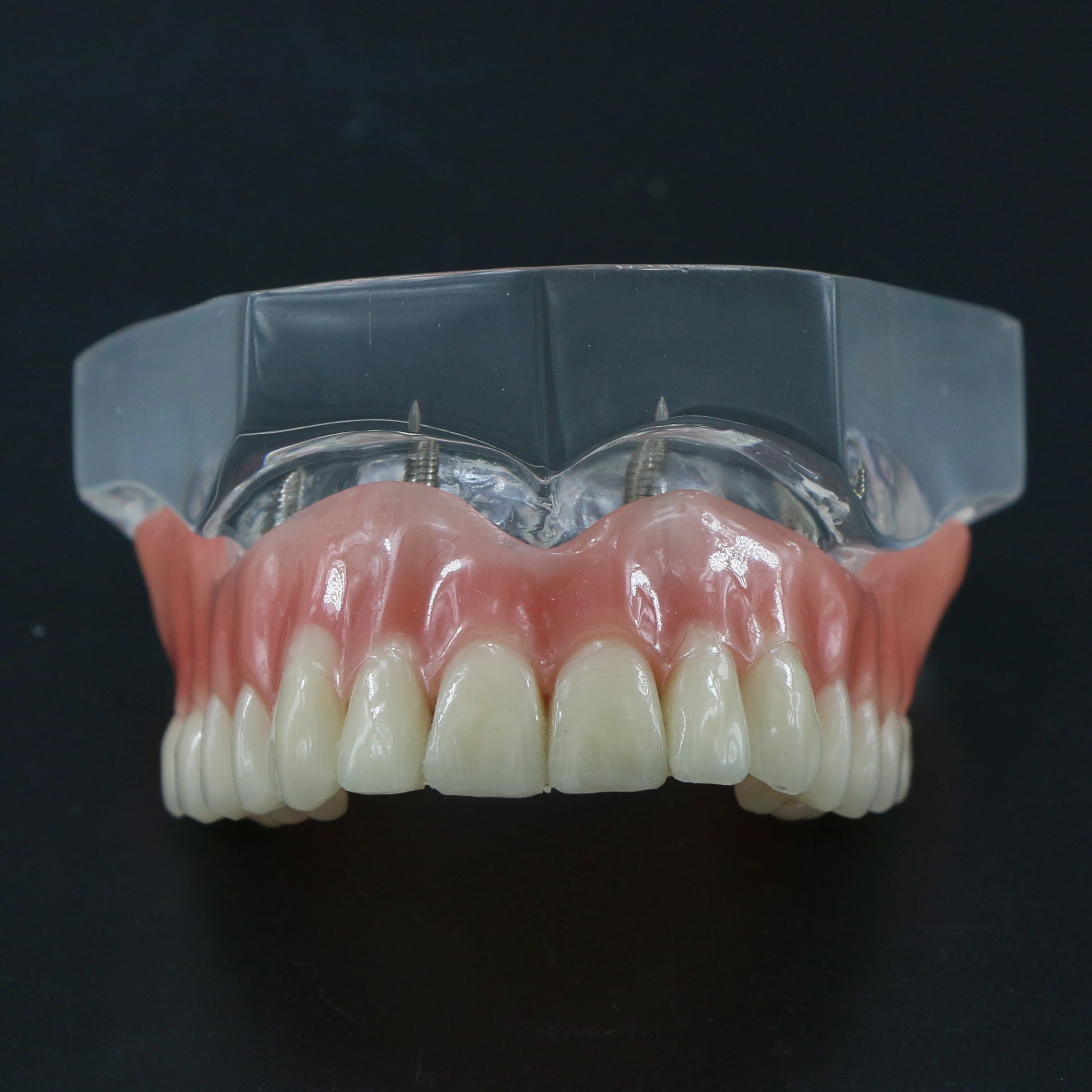 Фото Dental Upper Overdenture Превосходные 4 имплантаты Демо-модель 6001C Модель зубов №3