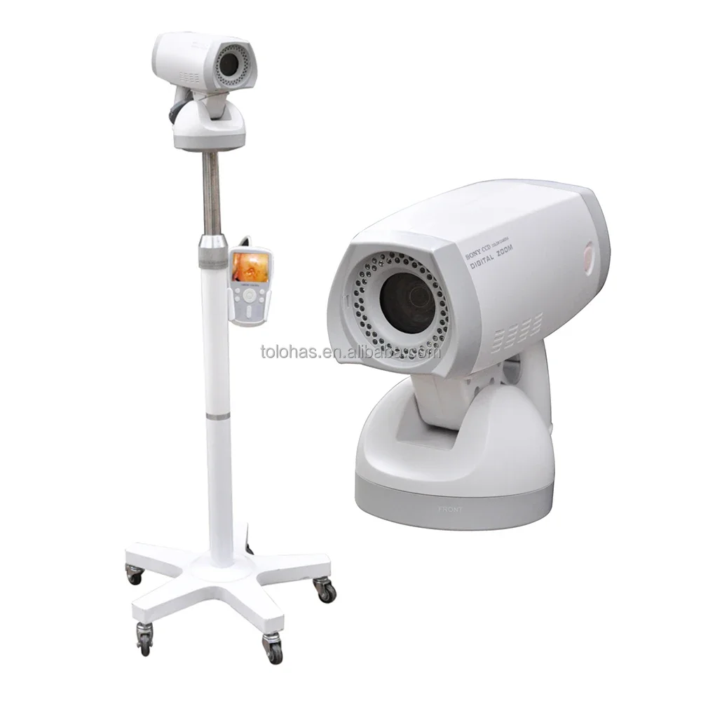 Фото LH9800A Колпоскопия Гинекология Full HD Цифровая электронная видеокольпоскопия для гинекологии/кольпоскопическая машина №4