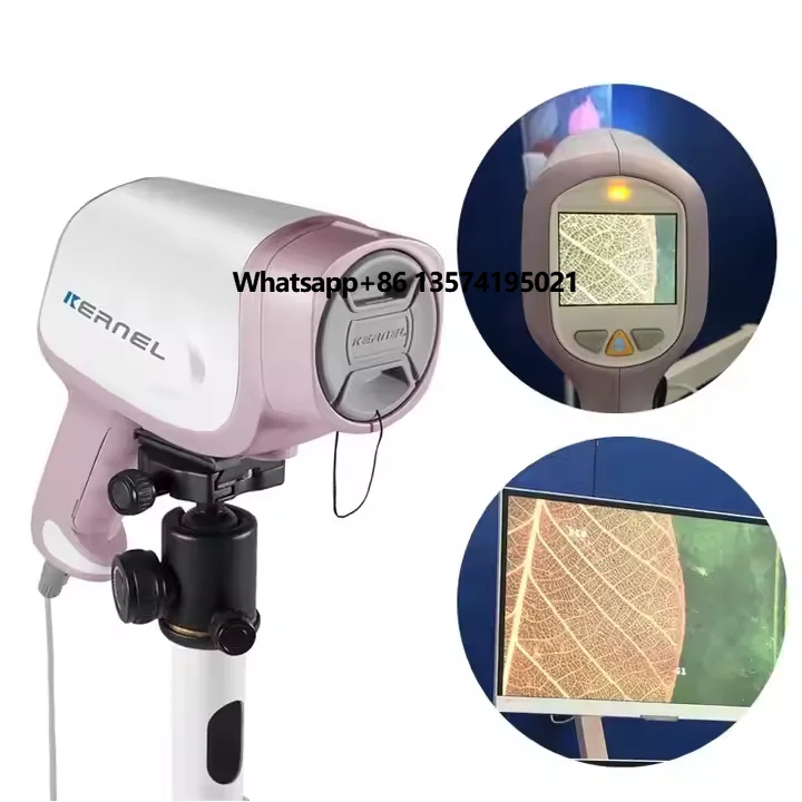 JYTOP Medical CE дешевая цена Full HD видеокольпоскоп эндоскоп колпоскоп для гинекологии