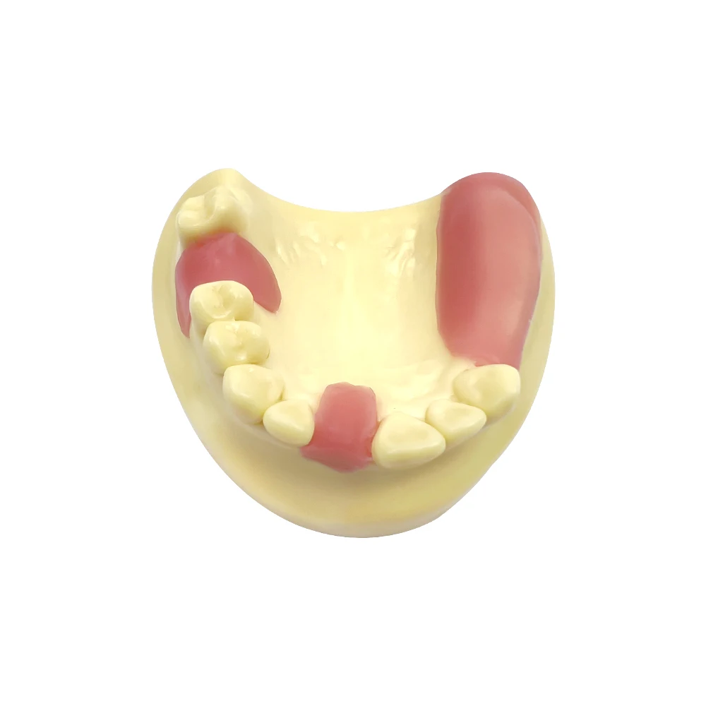Фото Стоматологическая модель, ручная модель, Overdenture, демонстрация мягких десен, для обучения клинике №5