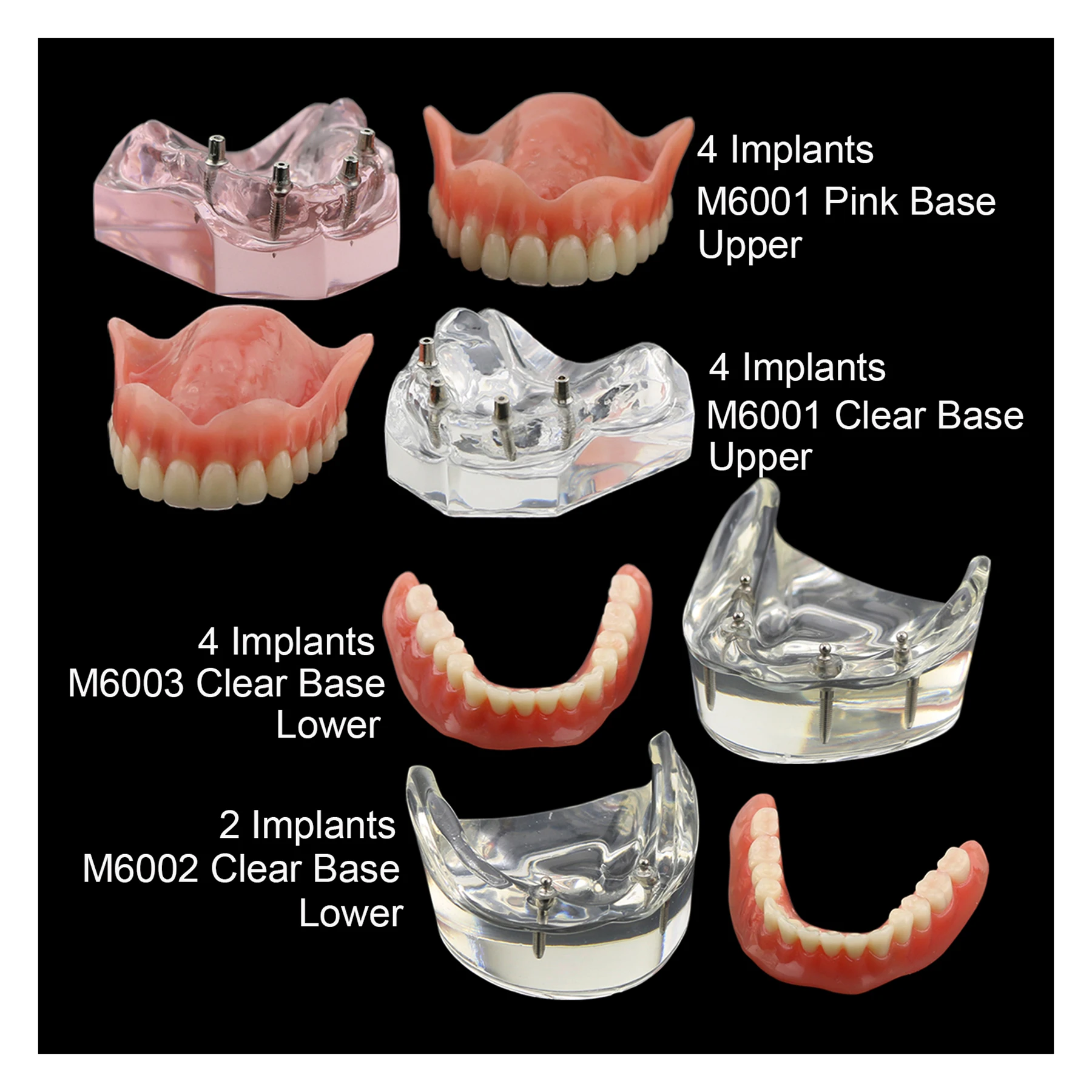 Зубной имплантат Overdenture, модель зубов M6001, M6002, M6003, имплантаты типофуз 2, 4, превосходный верхний низкий уровень, демонстрация восстановления
