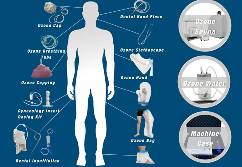 Gerador De Ozone Portatil Para Clinicas Ozono Terapia Озоновый медицинский аппарат для лечения артрита Y Reumatismo (art.: 3920cf20082f3) - 3920cf20082f3