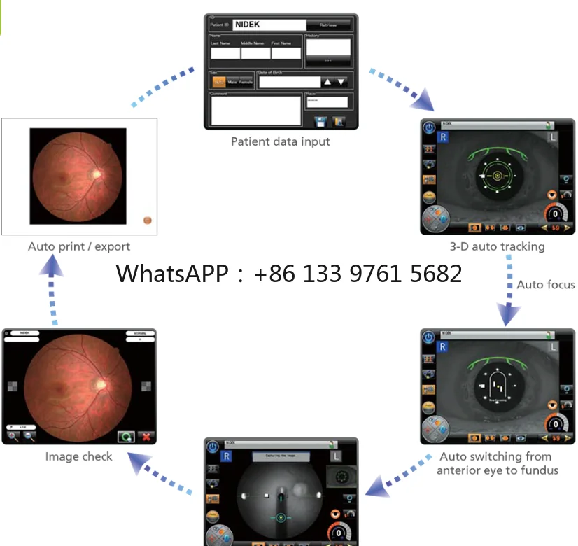 Фото Nidek AFC-330 Auto Fundus Camera 8,4-дюймовый наклонный цветной ЖК-сенсорный экран Ультразвуковое электронное оборудование Fundus Camera Price №4