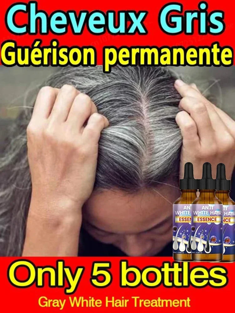Сыворотка perawatan rambut abu-abu, Nutrisi, Nutrisi perbaikan warna лампы alami ke Hitam Perawatan Rambut rontok Pria Wanita