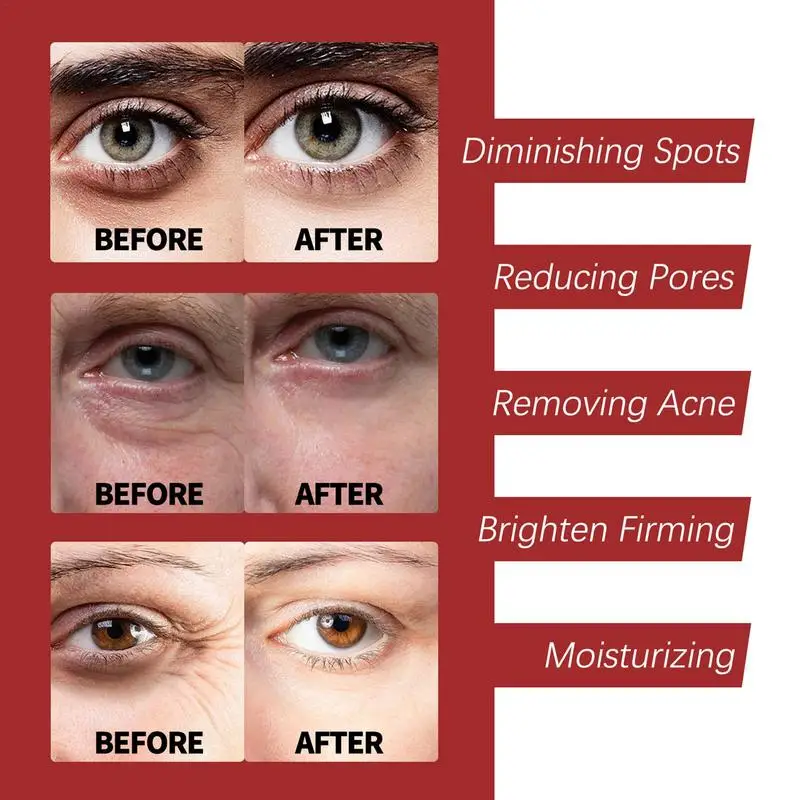 Фото Увлажняющий крем для лица Retinol, Осветляющий крем для лица, антивозрастной питательный крем от морщин №5