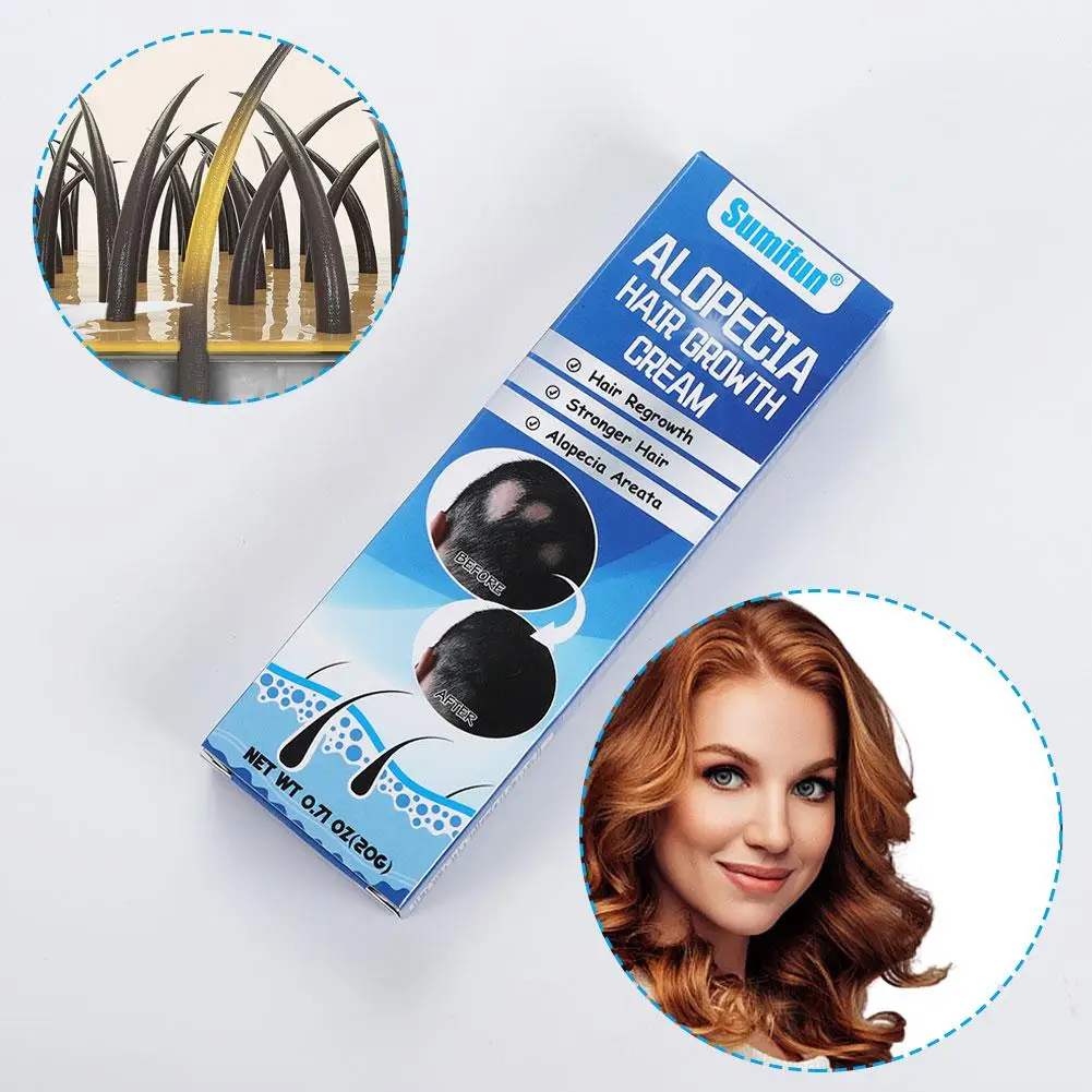 Крем для ухода за кожей головы Sophora Flavescens Alopecia Areata Крем для волос 20 г Средство по уходу Крем для ухода за кожей головы T0T1