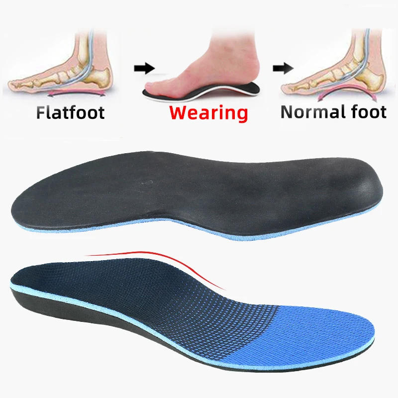 Mannen Schoen Accessoires Platvoeten Arch Ondersteuning Inlegzolen Orthopedische для женщин X/O-Been Valgus Voet Massage Hoogt