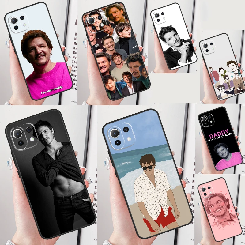Чехол для Xiaomi 13T 12T 11T 13 Pro 12 Lite 12X POCO F5 X4 F4 GT F3 M5s M6 X3 X5 Pro