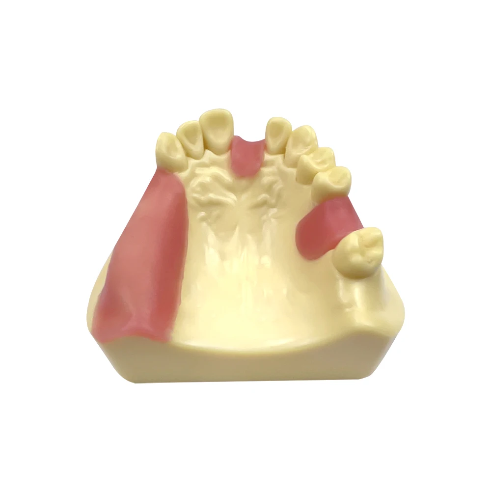 Фото Стоматологическая модель, ручная модель, Overdenture, демонстрация мягких десен, для обучения клинике №2