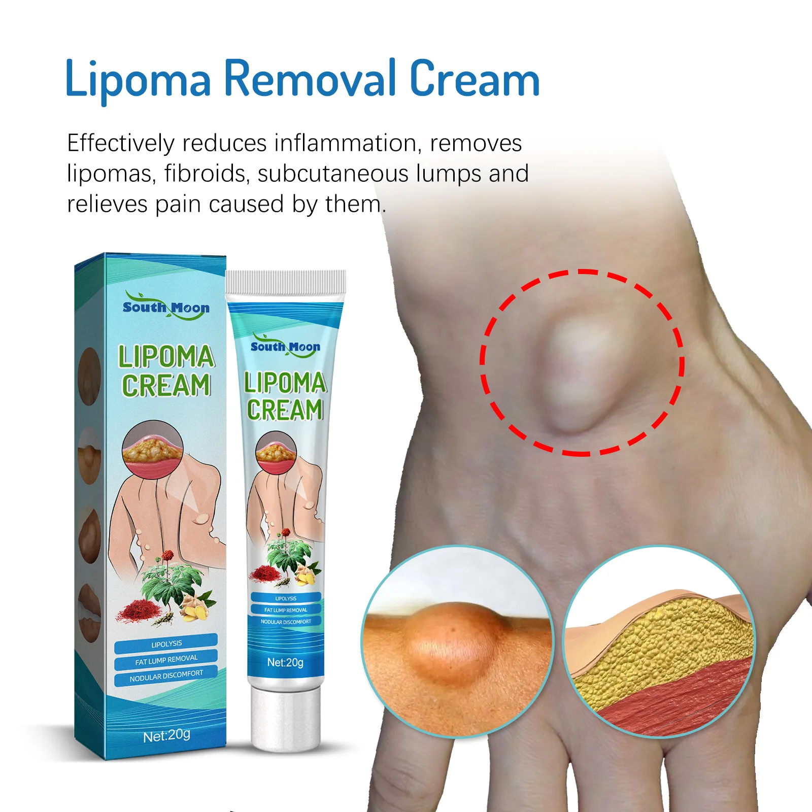 Фото Крем Lipoma для удаления жира и целлюлита, мазь от боли в коже, отеков, липолиза, удаления целлюлита, уплотнения ногтей, антиопухолевой пластырь №1